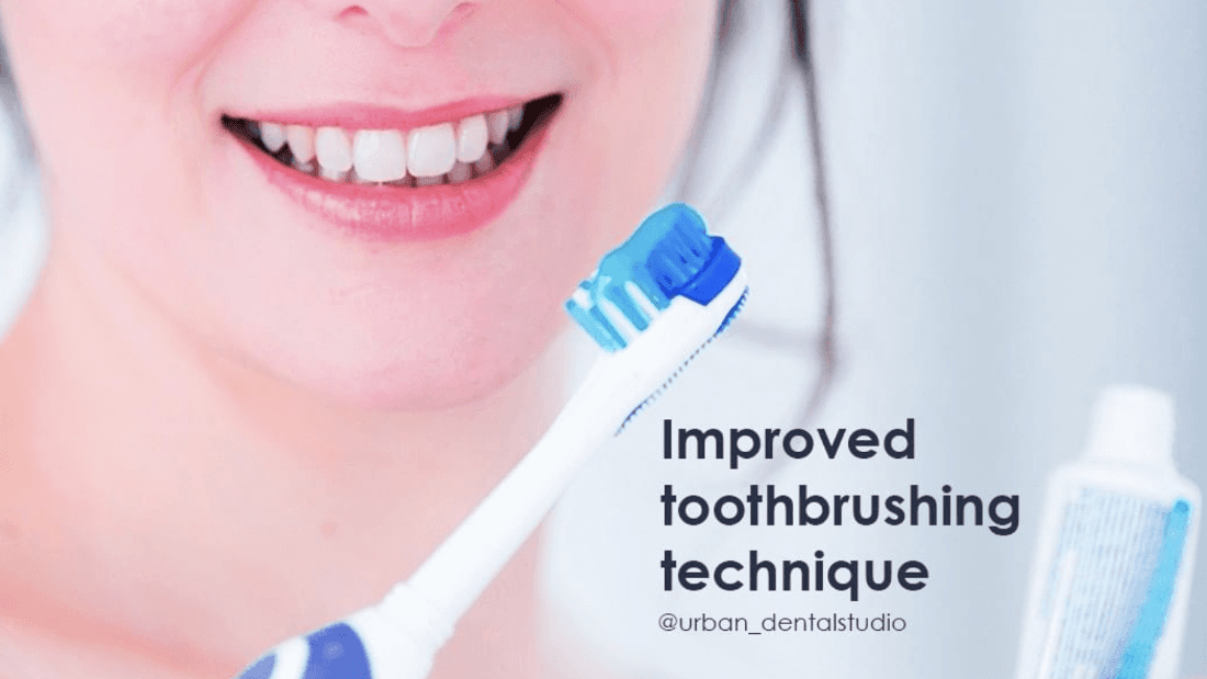 Improved Brushing Technique Other Auckland NZ