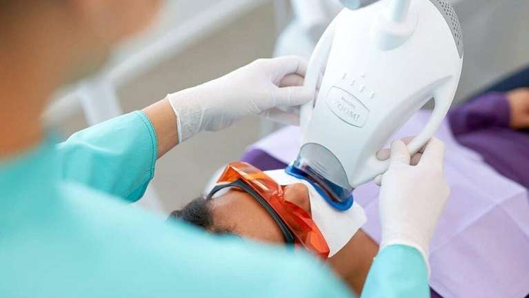 Teeth whitening